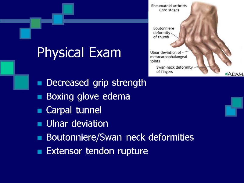 Physical Exam Decreased grip strength Boxing glove edema Carpal tunnel Ulnar deviation Boutonniere/Swan neck